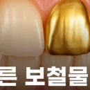 센트럴청원치과의원 네이버블로그