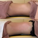 만덕1동-5 | 부산 북구 만덕역 [브이오미 에스테틱] 복부관리 내돈내산 후기! 피부•바디관리 잘하는 곳 추천