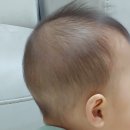 짱구머리 - 북구 | 짱구머리