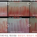 스타링