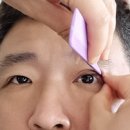 남편 #상안검 수술해 주기 (나는 김봉사 부인 요나심청이 )