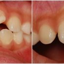 림플란트치과의원 이미지