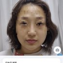 에이치알포커스