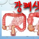 사암침법 - 장폐색 치료 방법 - 비과학적 양의학 92 이미지