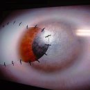 서울성모안과병원 이미지