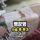 알자 | 맹장염 전조증상 수술 후 후기 충수염 제대로 알자