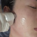 김라인샵 | 군산피부샵 군산피코토닝 전문 "보금뷰티"에서 기미잡티부터 리프팅까지 한꺼번에 관리받은 후기