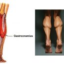 종아리가 굵어서 고민, 하체운동 할까? 말까? 이미지
