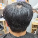 리턴헤어 | 리턴헤어 탈모 히든펌 진짜 리얼 후기