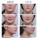 서울고운미소치과교정과치과의원 이미지