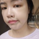 아셀문구 | 여의도 쥬브아셀V 피부 속부터 자유롭게 차오르는 자연스러운 볼륨