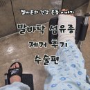 현민실업춘천지점주 | 발바닥 섬유종 (혹) 제거 후기