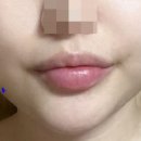 엘성형외과의원 이미지