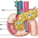 췌장이상신호 이미지