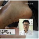 푸스올