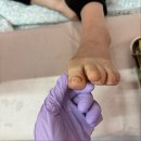 Nail 831 | 목포 산정동 내성발톱 부모님 관리시켜드렸어요 루&나 뷰티풋케어 센터