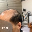 이루리태권도장 | 용인 수지 상현역 남자가발 후기 │ 늦게 시작했지만 “진작 쓸걸”