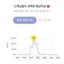 블링PC | 렌블링 퓨어블 애쉬브라운 내돈내산 후기, 축고정 렌즈 실착 후기