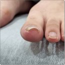 양천로67길 | 강서 염창동 내성발톱 편한 걸음되는 관리 빠른회복 365웰 강서지점