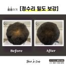 블랙인스칼프 이미지