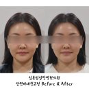 원광한의원 | 논현역 심용섭십장생한의원에서 안면비대칭교정 받아 본 후기 공유