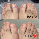 대흥동물병원 | 하이푸스 마포대흥점 : 발각질, 문제성발톱, 내성발톱 마포 발케어 신세계 솔직후기