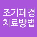 조기폐경 더이상 방치말고 바로 치료받자! [조기폐경 치료방법] 이미지