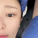 라렌에스테틱 이미지