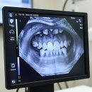 웃는미래치과의원 | 치아 고민, 이제 찐친한테 맡긴다! 바로이치과의원 체험기