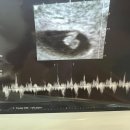 서구보건소(6) 이미지