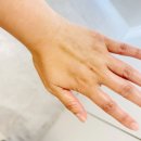 미르피부과의원 | 🔥 의정부피부관리 &amp; 화이트태닝 후기 – 몰디브태닝 의정부점