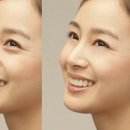 누늘브로우