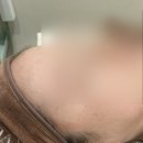 비비드에스테틱 | [검단 비비드엘] 검단신도시 에스테틱에서 기미 잡티 관리받은 솔직후기