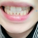 서울나우치과의원 네이버블로그
