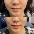 루시아 피부관리