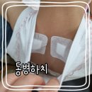 함소아한의원 여름한정 동병하치 (면역력강화, 감기예방) 치료&amp;진료후기