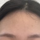 이지아이반영구 네이버블로그