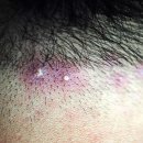 존스킨한의원 이미지