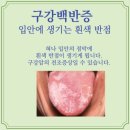 울산광역시부르미노동조합 | 四字成語 총정리 &lt;ㄱ&gt; 843 구강과학~구강세균