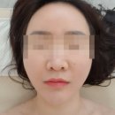 군포산본피부관리 타임투뷰티에서 진정관리 받고 온 솔직 후기