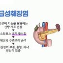 급성췌장염 증상 만성 췌장염 초기증상 예방 치료 자세히 이미지