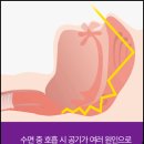 변산온누리약국 | 코골이 고치는법 비강확장기, 수술 다 필요 없습니다.(ft. 코골이스프레이 스노킬)