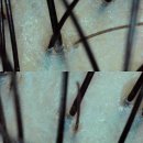 ORGA beauty(올가뷰티) | [해운대 두피관리] 환절기 건조함, 해운대 ORGA 올가드림뷰티 마린시티점에서 해결! (솔직 후기)
