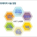 진성레이져 이미지