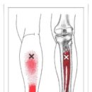 Tibialis Posterior (후경골근) 이미지