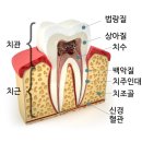 꾸러기치과 네이버블로그