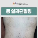 알라딘한의원 | 한의원 알라딘필링 진단에 따른 강도, 횟수가 중요