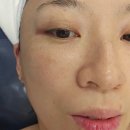 미샵 | 부천 피부관리 촉촉함에 한도 초과인 미샵에서 후기