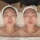 볼륨업컴퓨터 | 동탄얼굴경락 선에스테스파 동탄역점 울트라볼륨업4D 후기