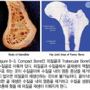 새로이치과기공소 | 오스템임플란트 네비게이션 전체 임플란트 치료일기. 치료과정/치료기간/비용/솔직후기.
